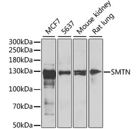 Western Blot - Anti-Smoothelin Antibody (A12010) - Antibodies.com