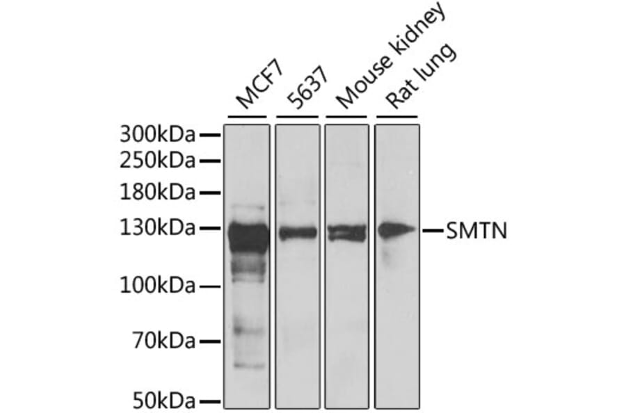 Western Blot - Anti-Smoothelin Antibody (A12010) - Antibodies.com
