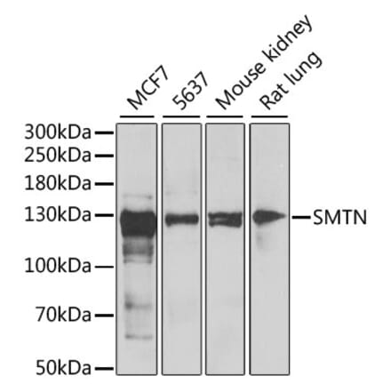 Western Blot - Anti-Smoothelin Antibody (A12010) - Antibodies.com