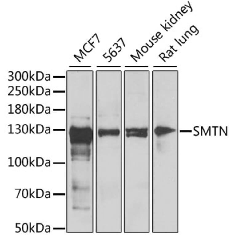 Western Blot - Anti-Smoothelin Antibody (A12010) - Antibodies.com