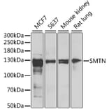 Western Blot - Anti-Smoothelin Antibody (A12010) - Antibodies.com