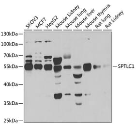 Western Blot - Anti-SPTLC1 Antibody (A12011) - Antibodies.com