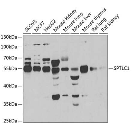 Western Blot - Anti-SPTLC1 Antibody (A12011) - Antibodies.com
