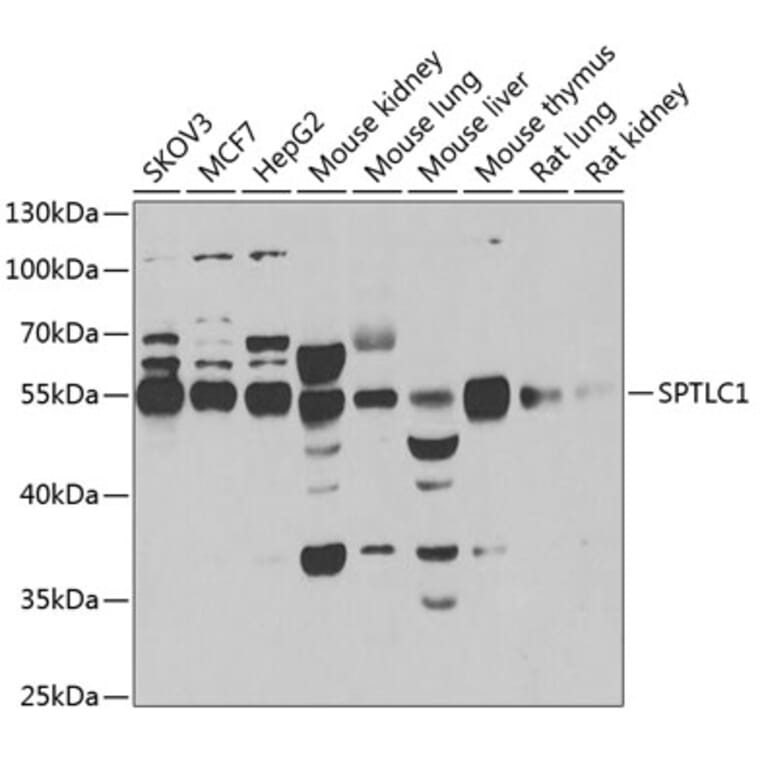 Western Blot - Anti-SPTLC1 Antibody (A12011) - Antibodies.com