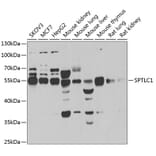 Western Blot - Anti-SPTLC1 Antibody (A12011) - Antibodies.com