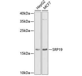 Western Blot - Anti-SRP19 Antibody (A12012) - Antibodies.com