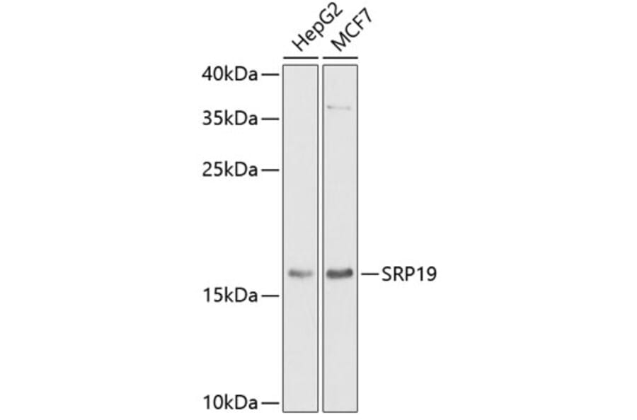 Western Blot - Anti-SRP19 Antibody (A12012) - Antibodies.com