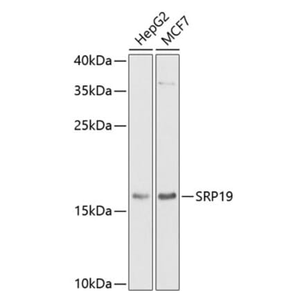 Western Blot - Anti-SRP19 Antibody (A12012) - Antibodies.com