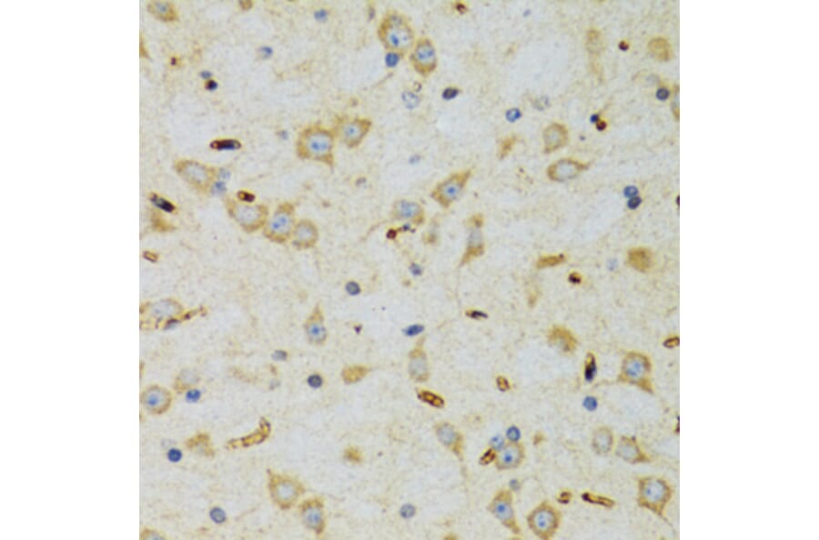 Immunohistochemistry - Anti-SRP19 Antibody (A12012) - Antibodies.com