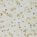 Immunohistochemistry - Anti-SRP19 Antibody (A12012) - Antibodies.com