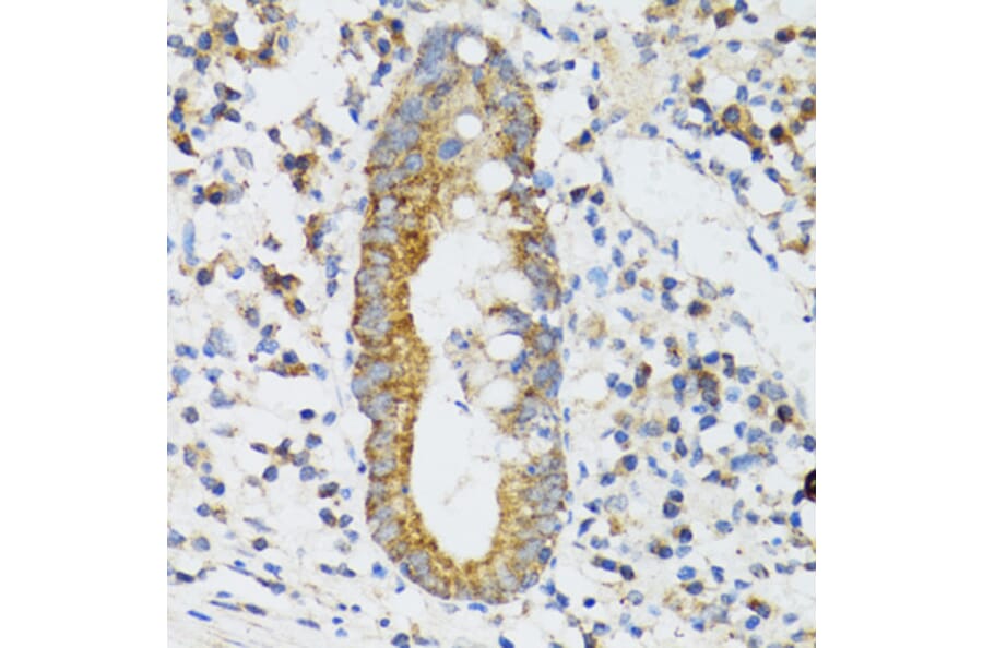 Immunohistochemistry - Anti-SRP19 Antibody (A12012) - Antibodies.com