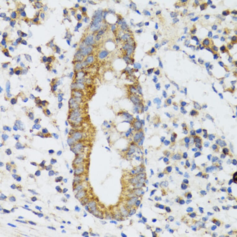Immunohistochemistry - Anti-SRP19 Antibody (A12012) - Antibodies.com