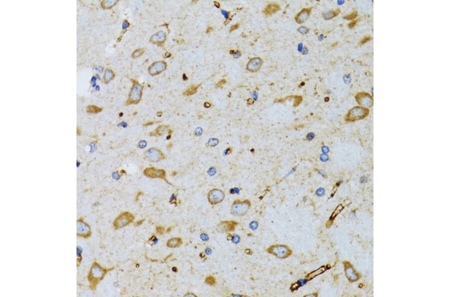 Immunohistochemistry - Anti-SRP19 Antibody (A12012) - Antibodies.com