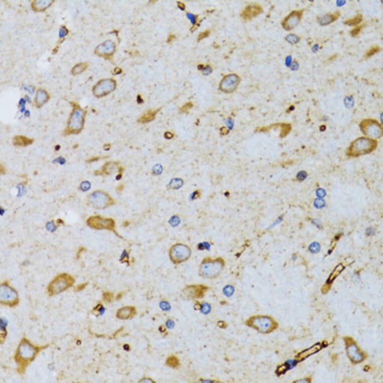 Immunohistochemistry - Anti-SRP19 Antibody (A12012) - Antibodies.com