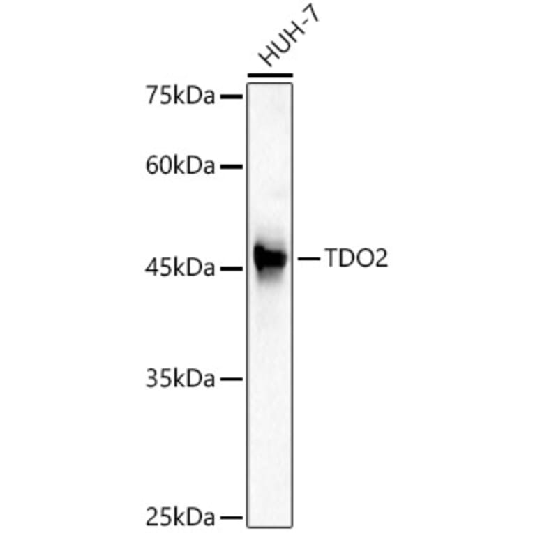 Western Blot - Anti-TDO2/TDO Antibody (A12014) - Antibodies.com