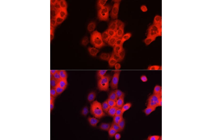 Immunofluorescence - Anti-TDO2/TDO Antibody (A12014) - Antibodies.com