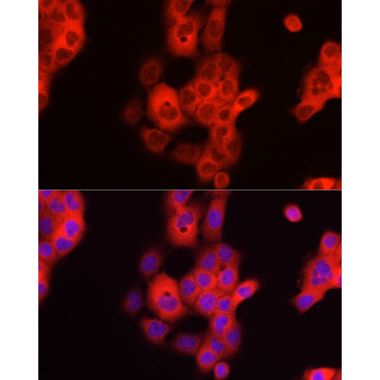 Immunofluorescence - Anti-TDO2/TDO Antibody (A12014) - Antibodies.com