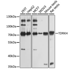Western Blot - Anti-TDRKH Antibody (A12015) - Antibodies.com
