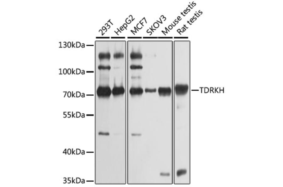 Western Blot - Anti-TDRKH Antibody (A12015) - Antibodies.com