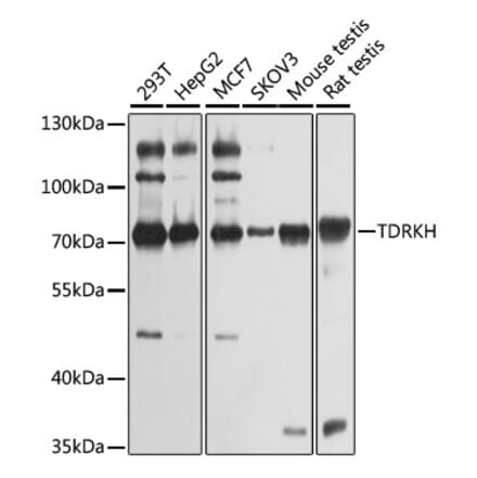 Western Blot - Anti-TDRKH Antibody (A12015) - Antibodies.com