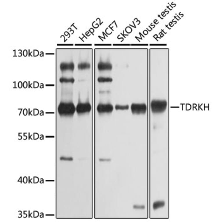 Western Blot - Anti-TDRKH Antibody (A12015) - Antibodies.com