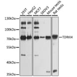 Western Blot - Anti-TDRKH Antibody (A12015) - Antibodies.com