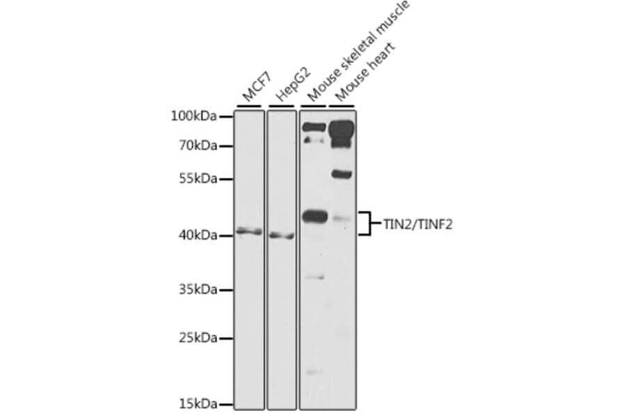 Western Blot - Anti-Tin2 Antibody (A12016) - Antibodies.com
