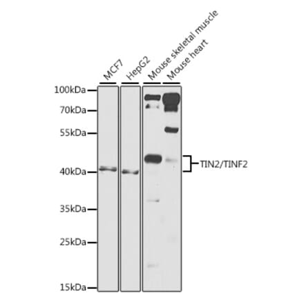 Western Blot - Anti-Tin2 Antibody (A12016) - Antibodies.com