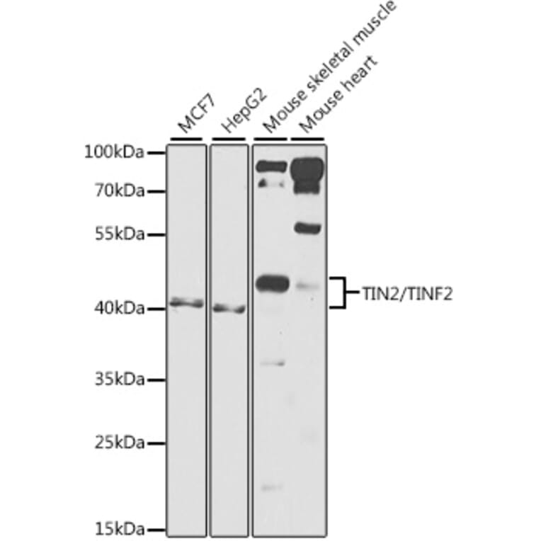 Western Blot - Anti-Tin2 Antibody (A12016) - Antibodies.com