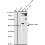 Western Blot - Anti-Tin2 Antibody (A12016) - Antibodies.com