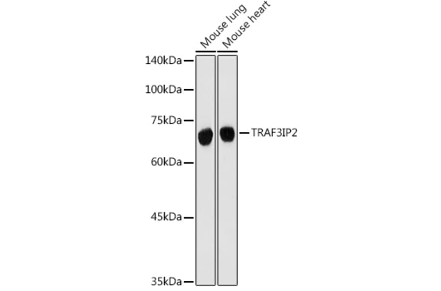 Western Blot - Anti-CIKS/ACT1 Antibody (A12017) - Antibodies.com