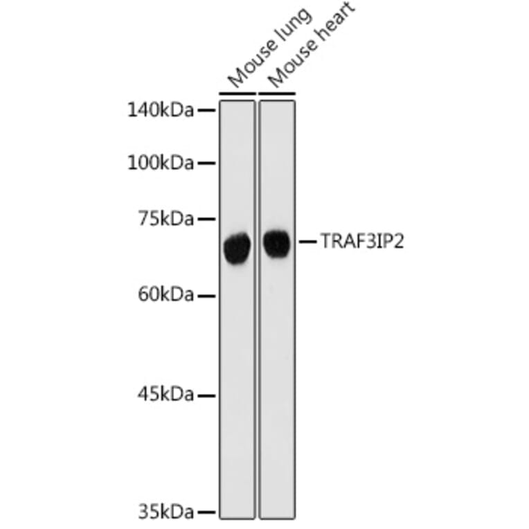 Western Blot - Anti-CIKS/ACT1 Antibody (A12017) - Antibodies.com