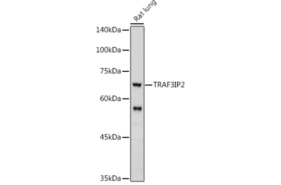 Western Blot - Anti-CIKS/ACT1 Antibody (A12017) - Antibodies.com