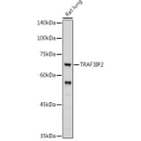 Western Blot - Anti-CIKS/ACT1 Antibody (A12017) - Antibodies.com