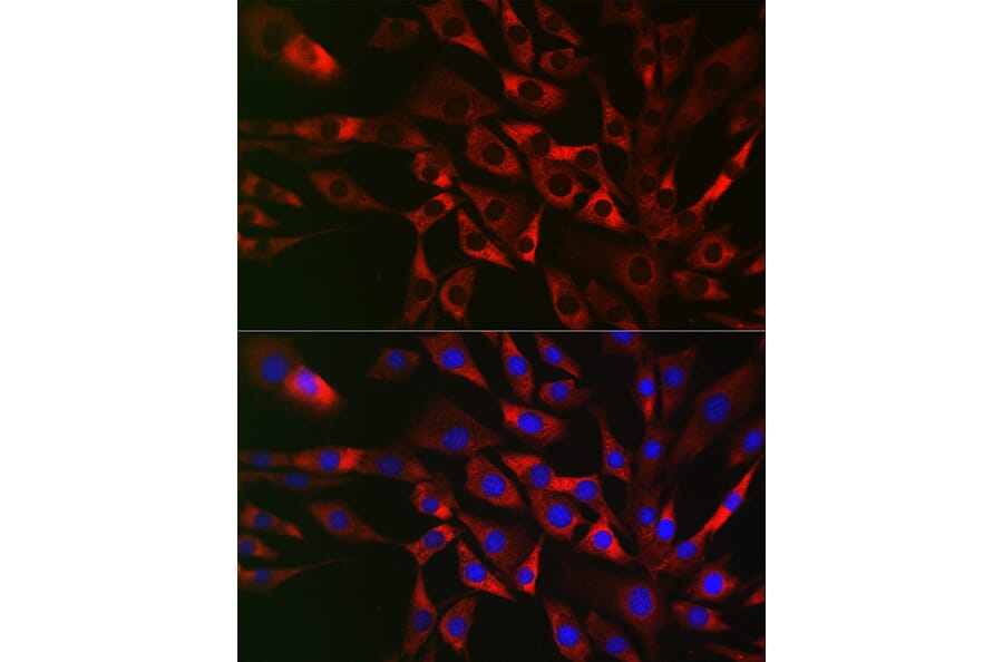 Immunofluorescence - Anti-CIKS/ACT1 Antibody (A12017) - Antibodies.com