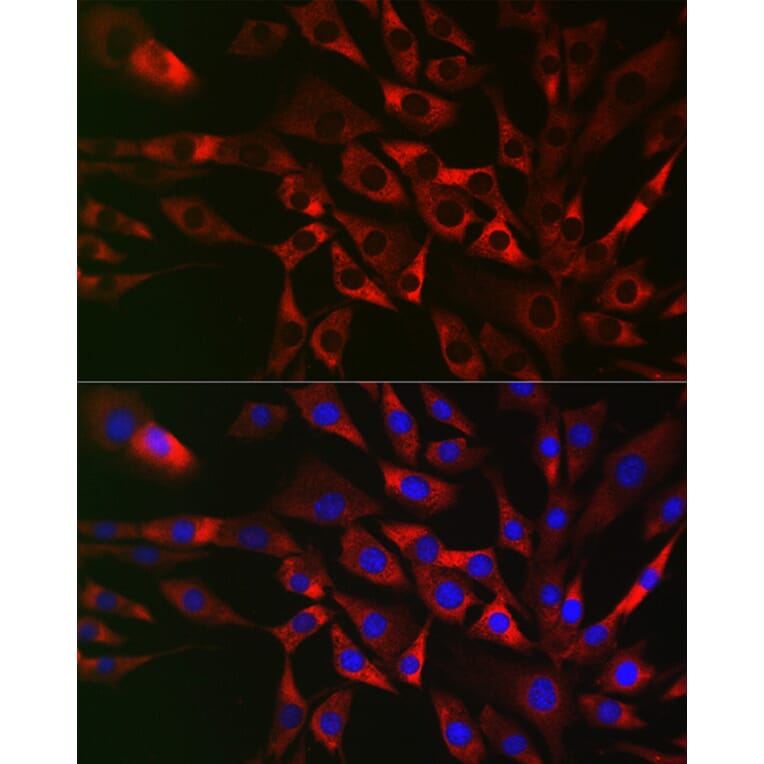 Immunofluorescence - Anti-CIKS/ACT1 Antibody (A12017) - Antibodies.com