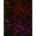 Immunofluorescence - Anti-CIKS/ACT1 Antibody (A12017) - Antibodies.com