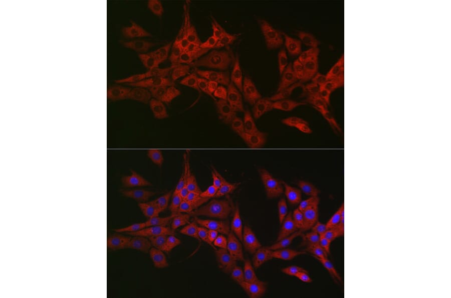 Immunofluorescence - Anti-CIKS/ACT1 Antibody (A12017) - Antibodies.com