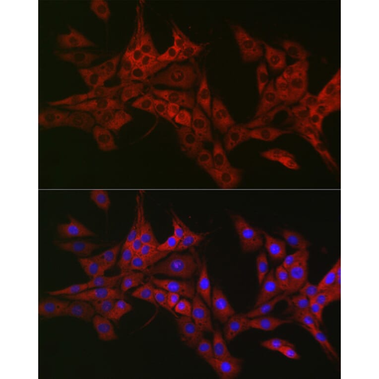 Immunofluorescence - Anti-CIKS/ACT1 Antibody (A12017) - Antibodies.com