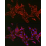 Immunofluorescence - Anti-CIKS/ACT1 Antibody (A12017) - Antibodies.com