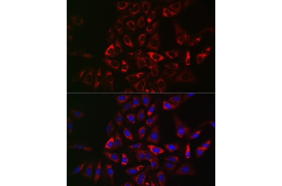 Immunofluorescence - Anti-CIKS/ACT1 Antibody (A12017) - Antibodies.com