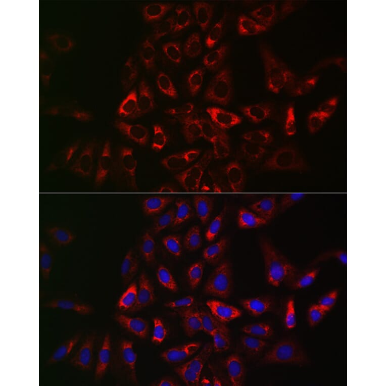 Immunofluorescence - Anti-CIKS/ACT1 Antibody (A12017) - Antibodies.com