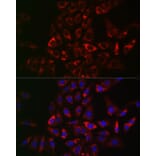 Immunofluorescence - Anti-CIKS/ACT1 Antibody (A12017) - Antibodies.com
