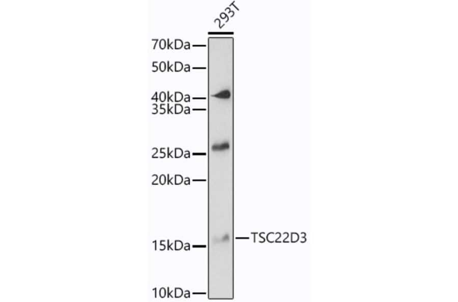 Western Blot - Anti-GilZ/TilZ Antibody (A12018) - Antibodies.com