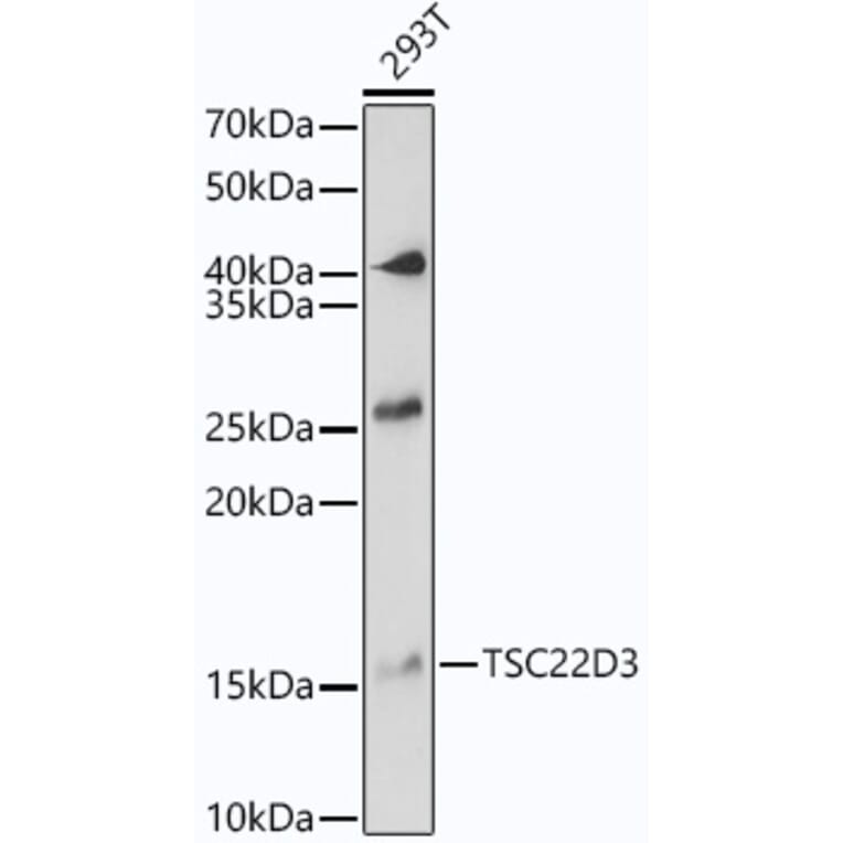 Western Blot - Anti-GilZ/TilZ Antibody (A12018) - Antibodies.com