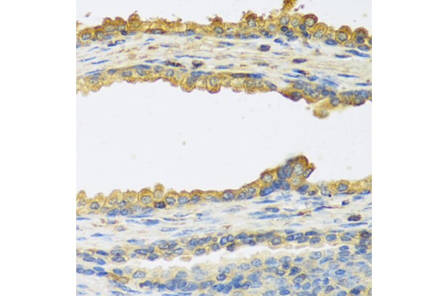 Immunohistochemistry - Anti-TSH beta Antibody (A12019) - Antibodies.com