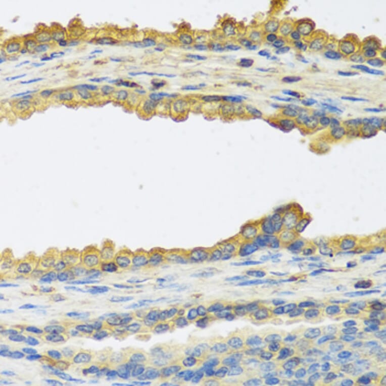 Immunohistochemistry - Anti-TSH beta Antibody (A12019) - Antibodies.com