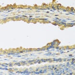 Immunohistochemistry - Anti-TSH beta Antibody (A12019) - Antibodies.com