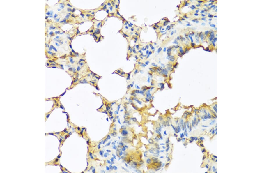 Immunohistochemistry - Anti-TSH beta Antibody (A12019) - Antibodies.com