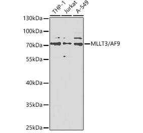 Western Blot - Anti-AF9 Antibody (A12020) - Antibodies.com